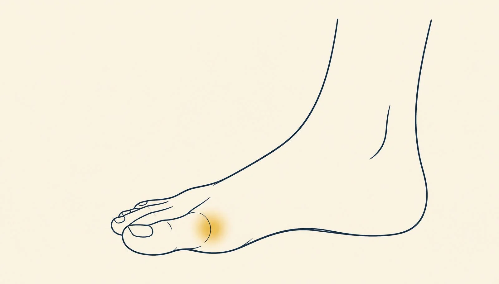 Føtter i romslige sko, sentralt for å bremse hallux valgus